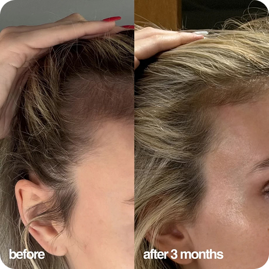 Bethany before and after
